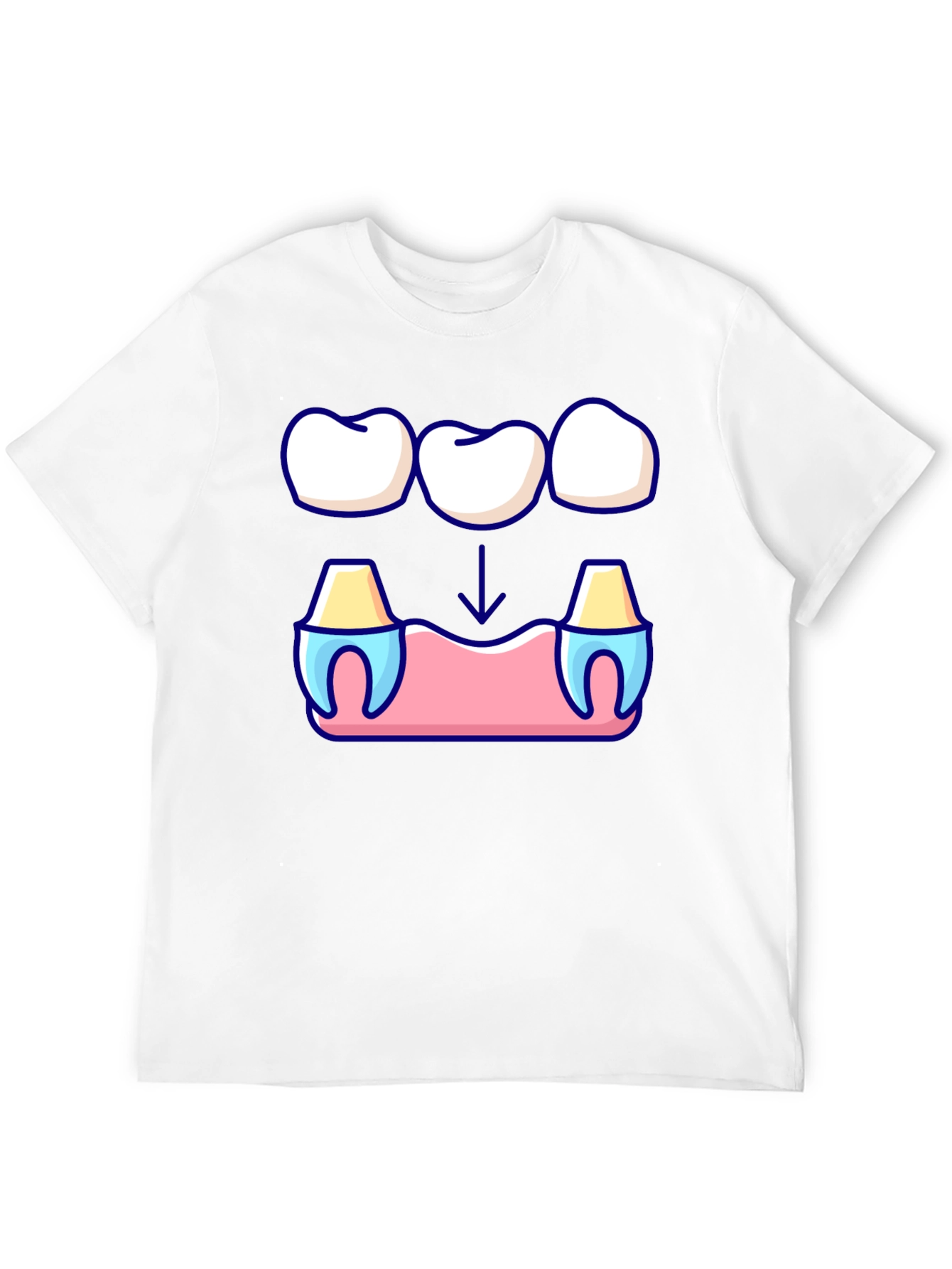Dental Bridge Graphic T-Shirt