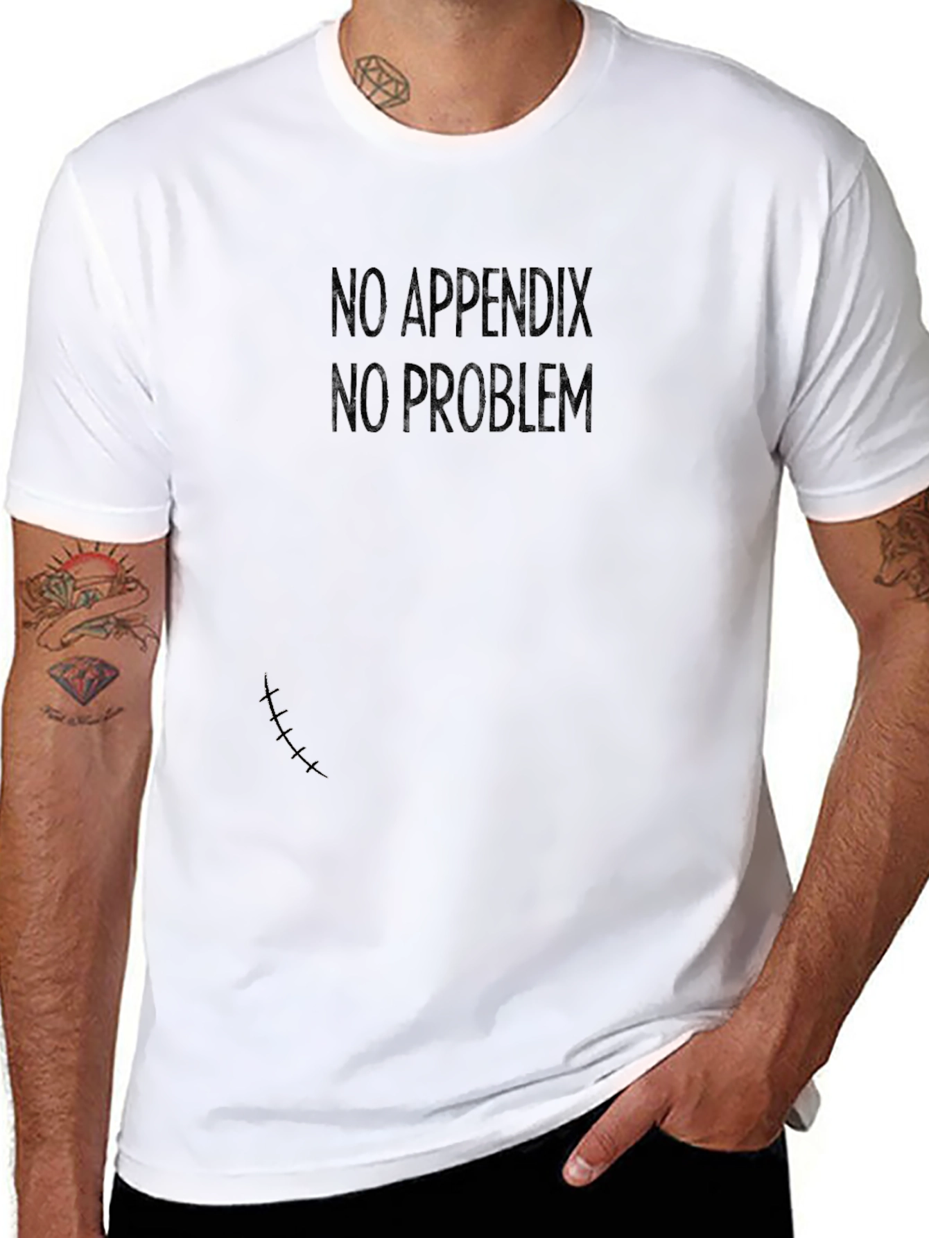 No Appendix No Problem T-Shirt - Funny Appendectomy Tee