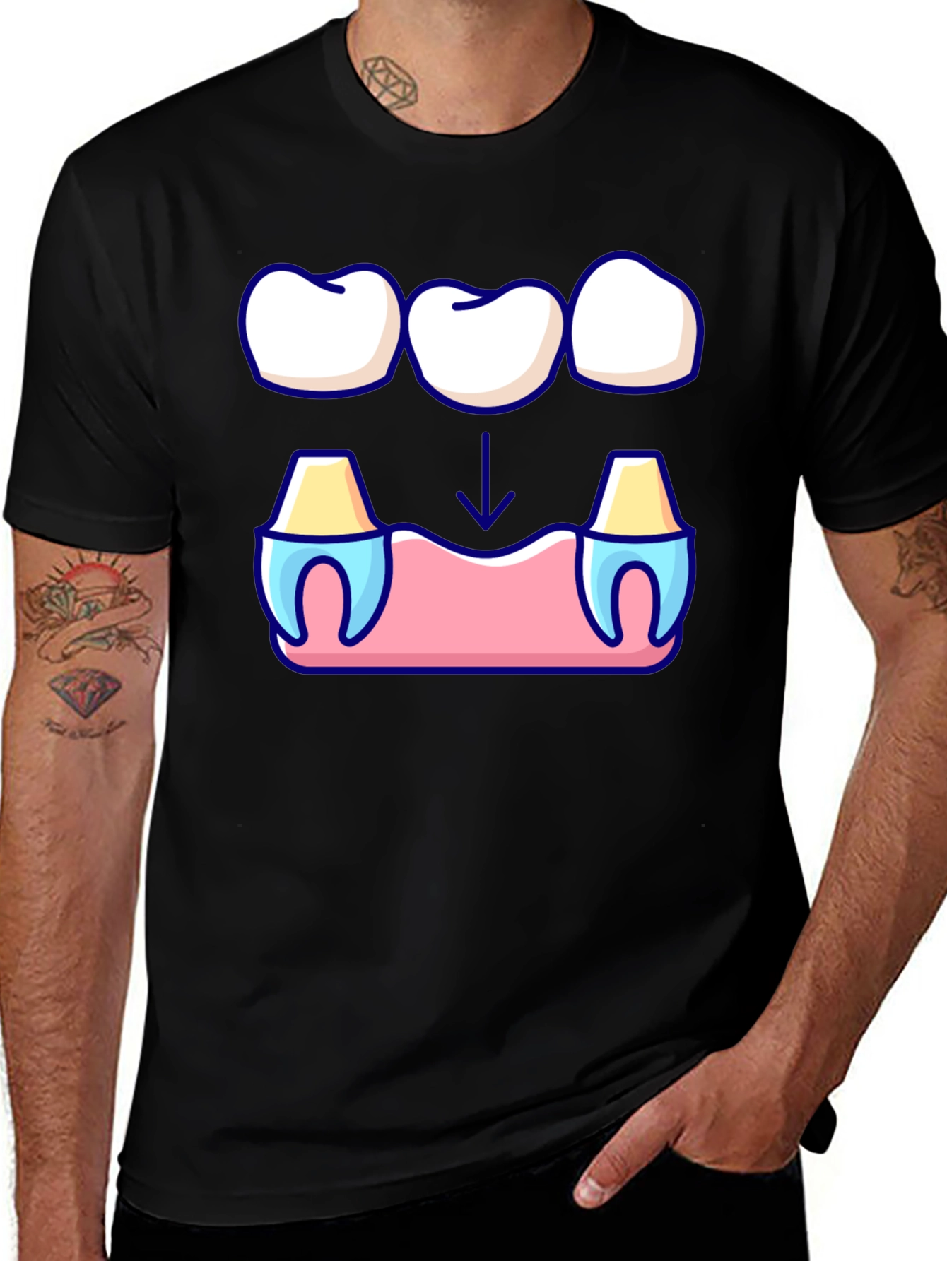 Dental Bridge Graphic T-Shirt