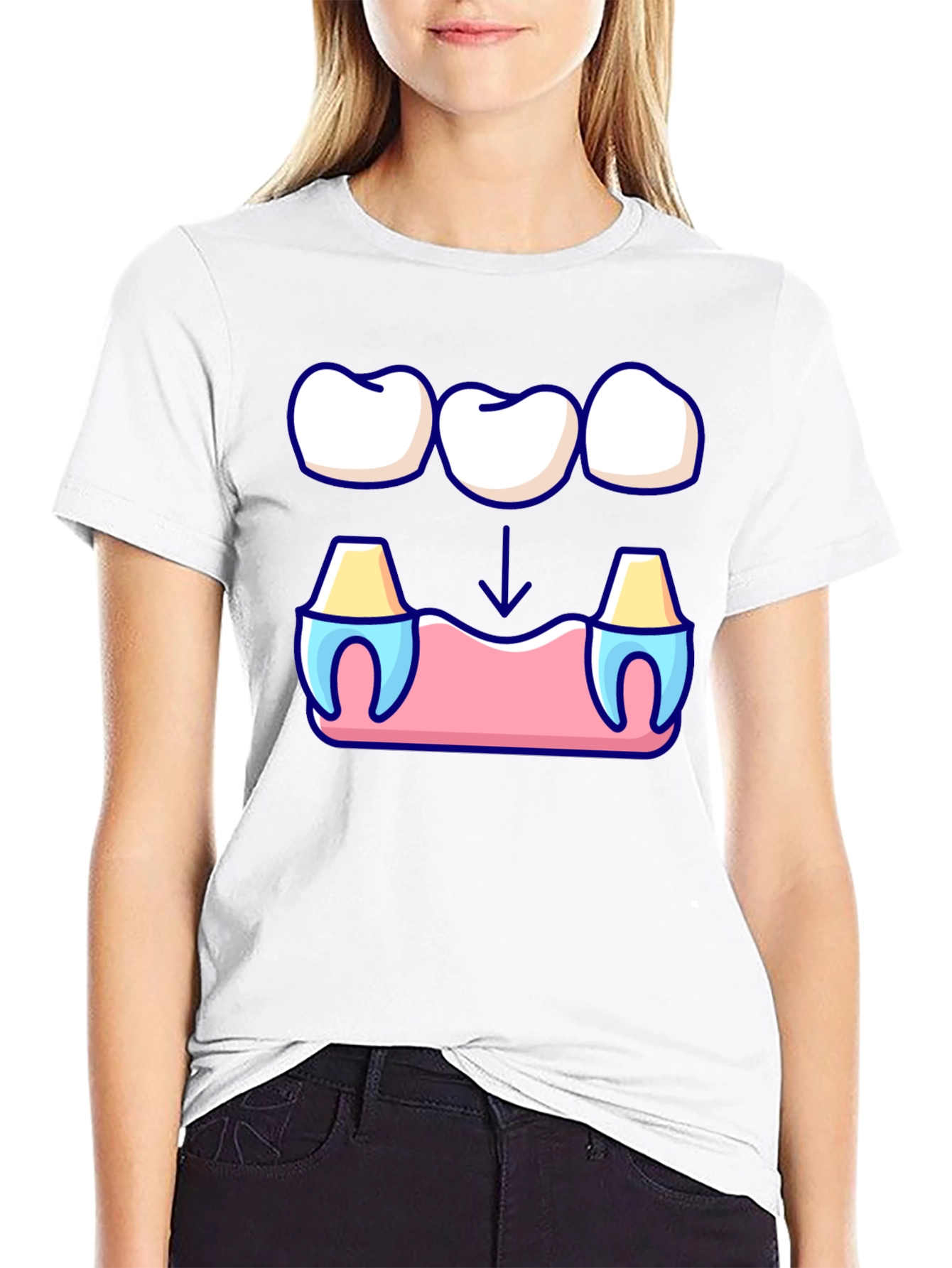 Dental Bridge Graphic T-Shirt