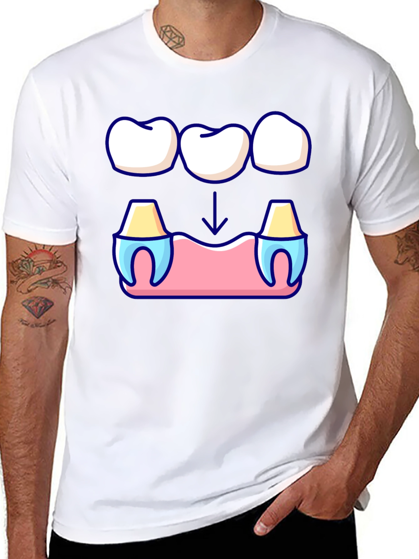 Dental Bridge Graphic T-Shirt