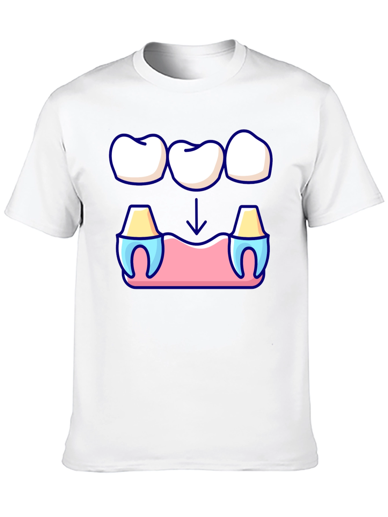 Dental Bridge Graphic T-Shirt