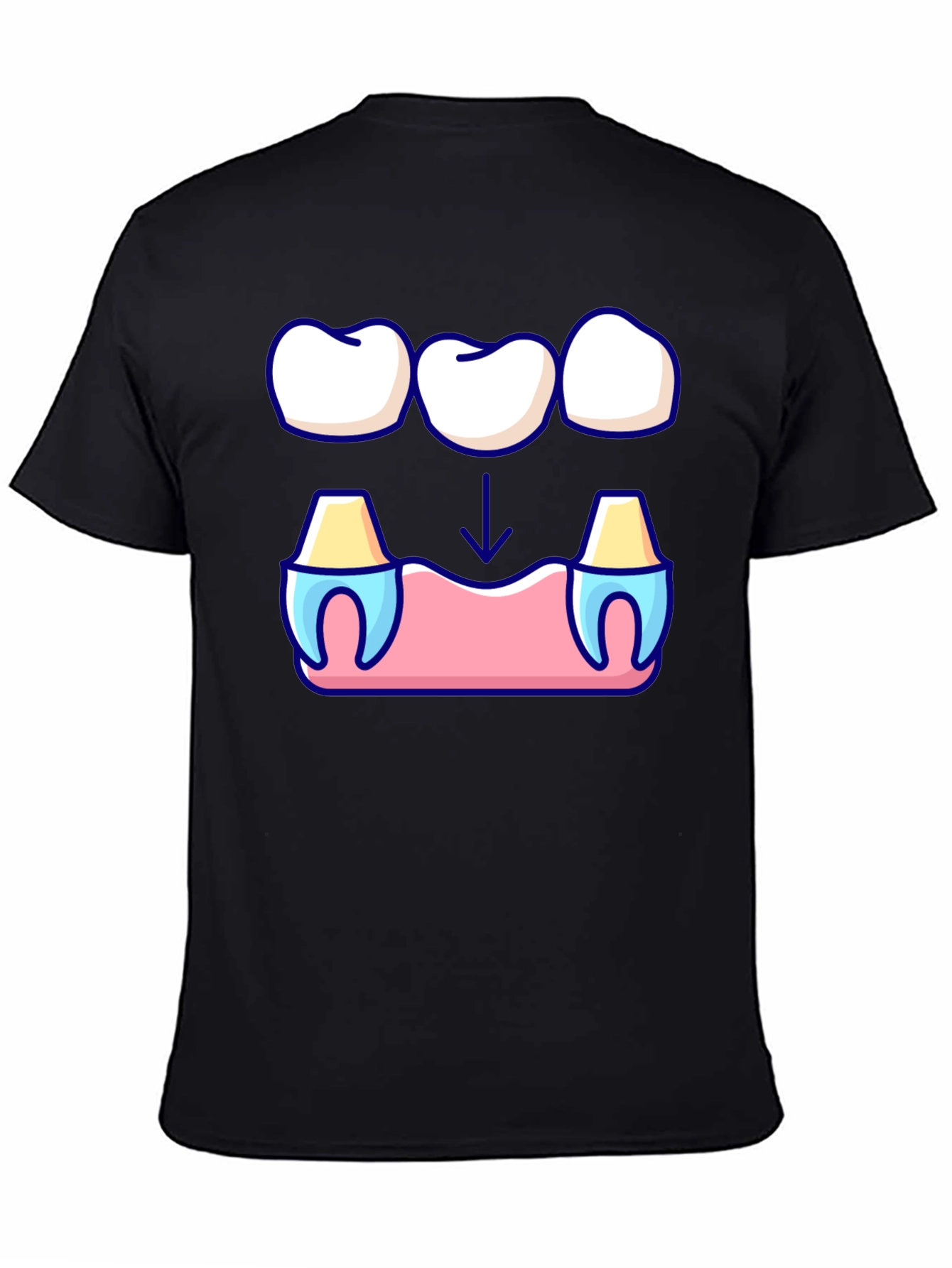 Dental Bridge Graphic T-Shirt